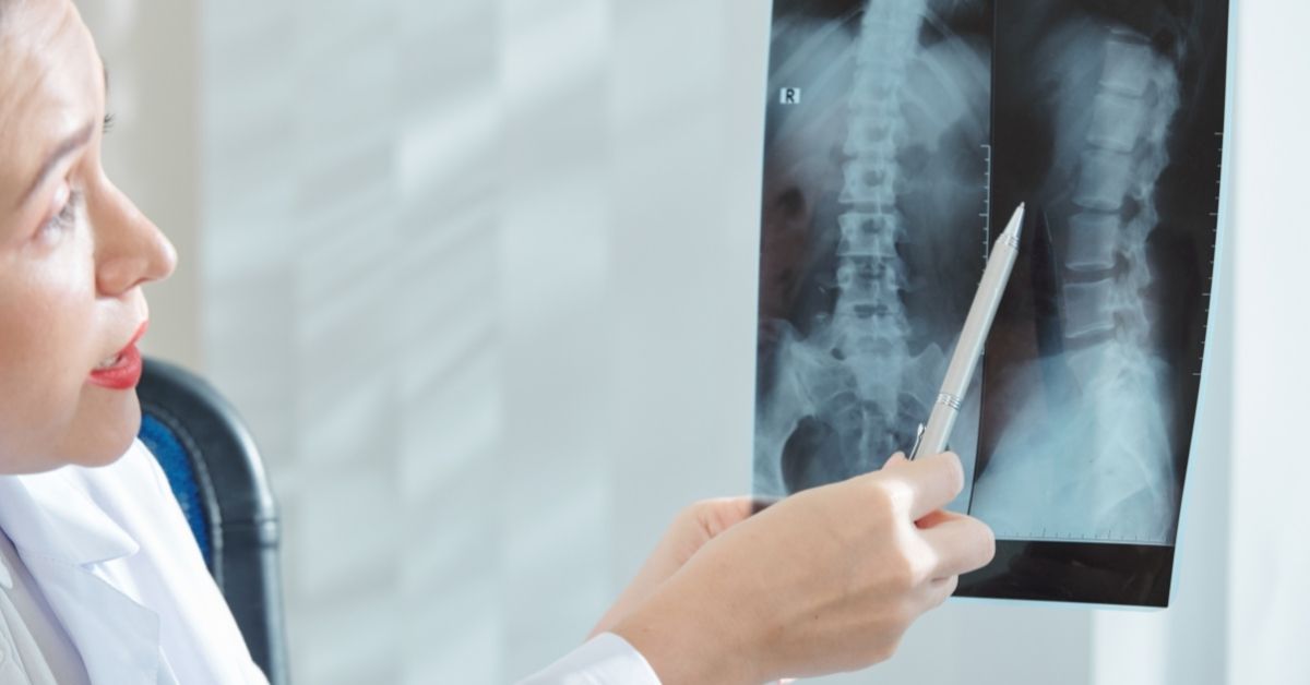 What Do Spine Surgeons Do In Plano Tx Minimally Invasive