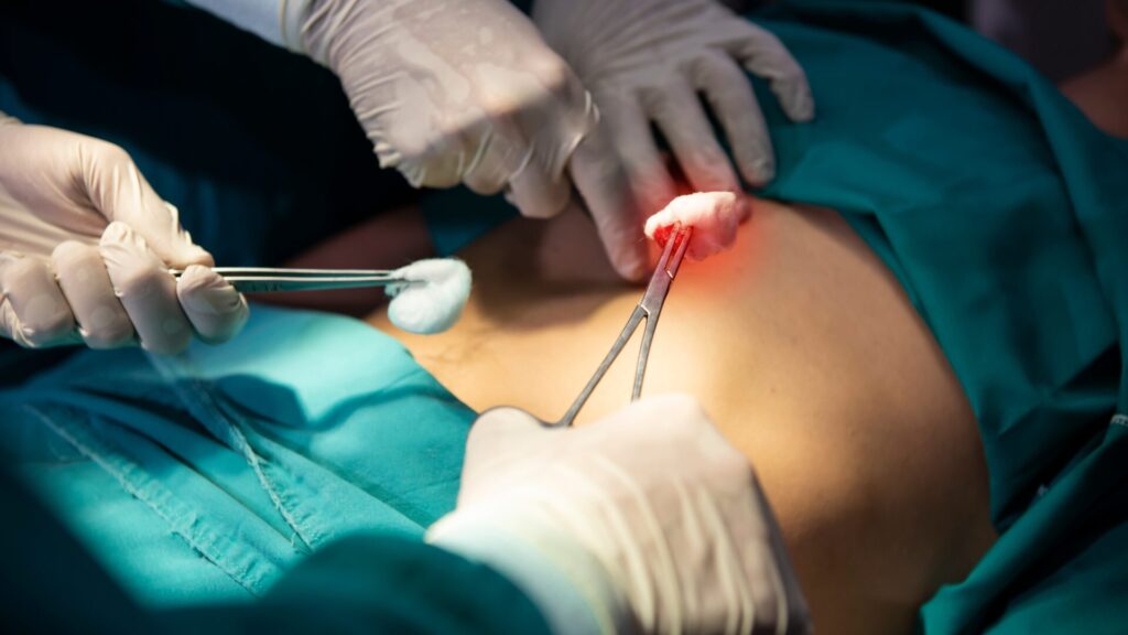 What Is Minimally Invasive Spine Surgery?