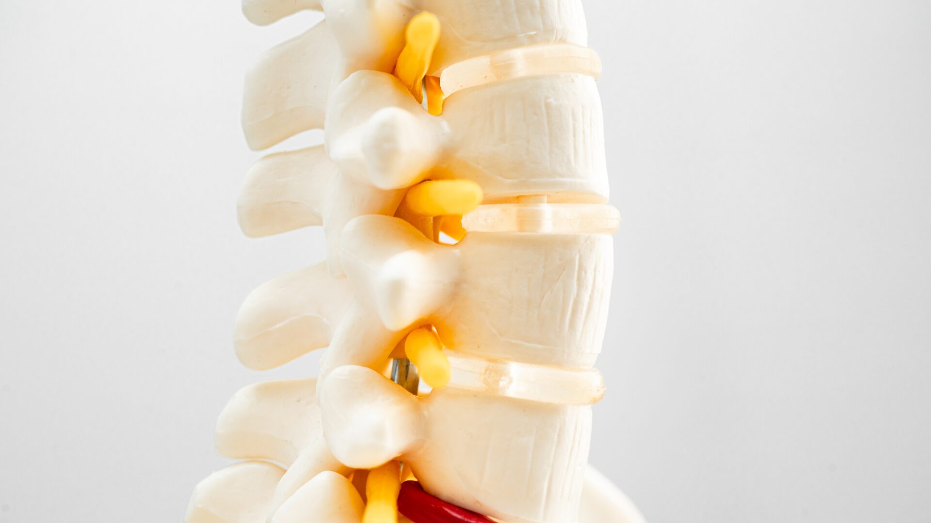 Looking for Spinal Stenosis Treatment in Dallas? Read This First