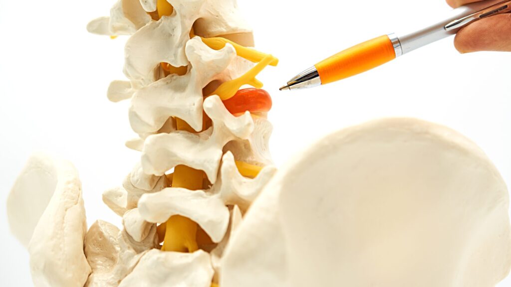 Essential Guide to Minimally Invasive Spine Surgery in Plano TX
