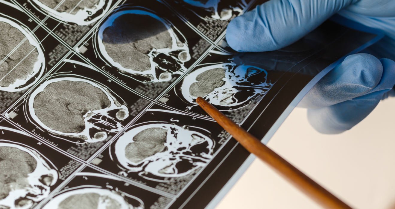 lower back doctor Plano TX