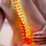 best spine doctor Frisco TX