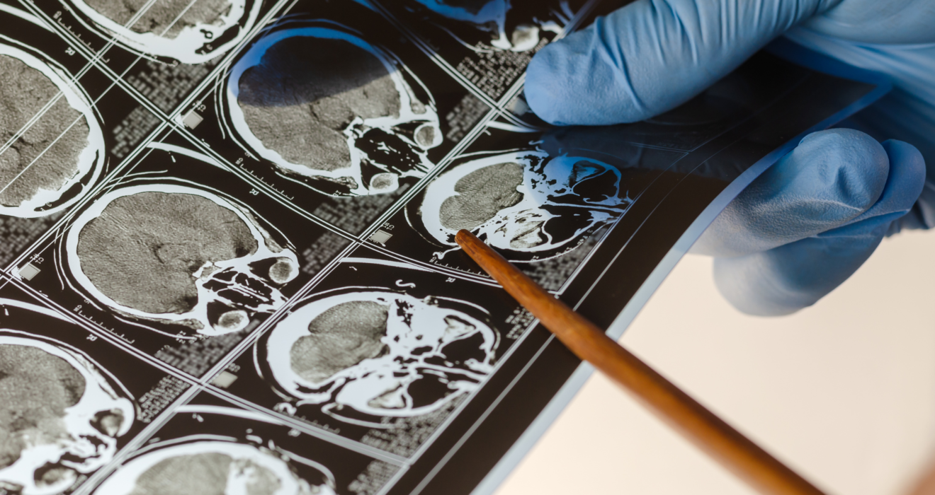 trusted spine surgeon Lewisville TX