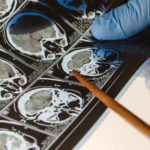 trusted spine surgeon Lewisville TX