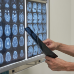 Minimally Invasive Surgery Lewisville TX