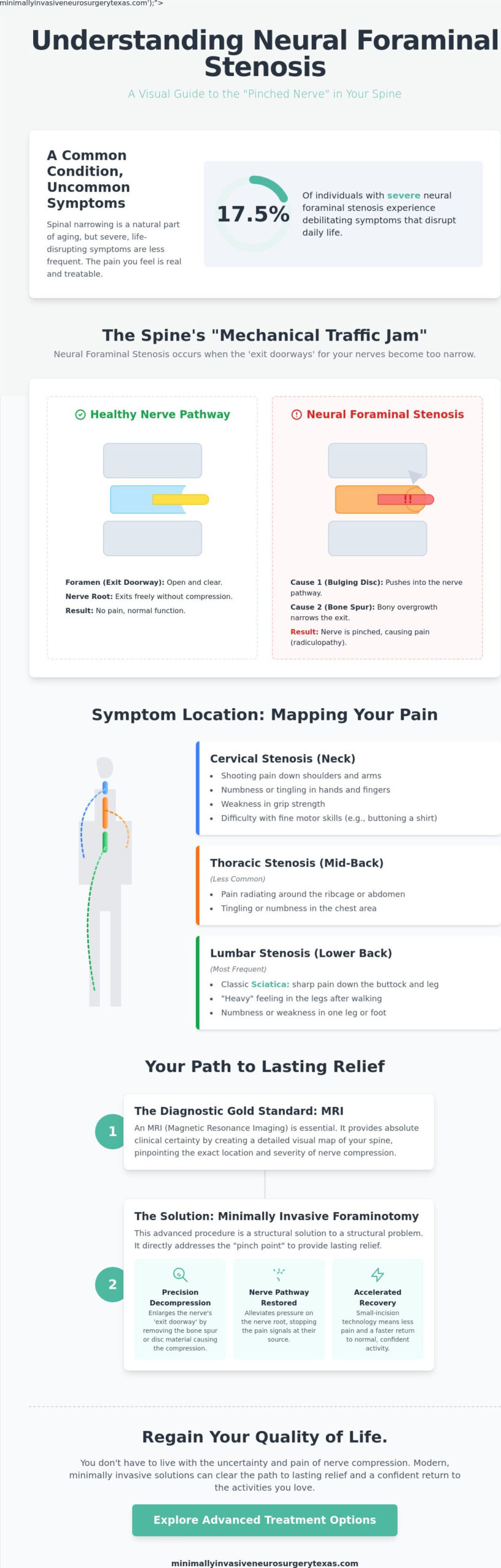 Neural Foraminal Stenosis: A Comprehensive Guide to Symptoms, Causes, and Modern Relief